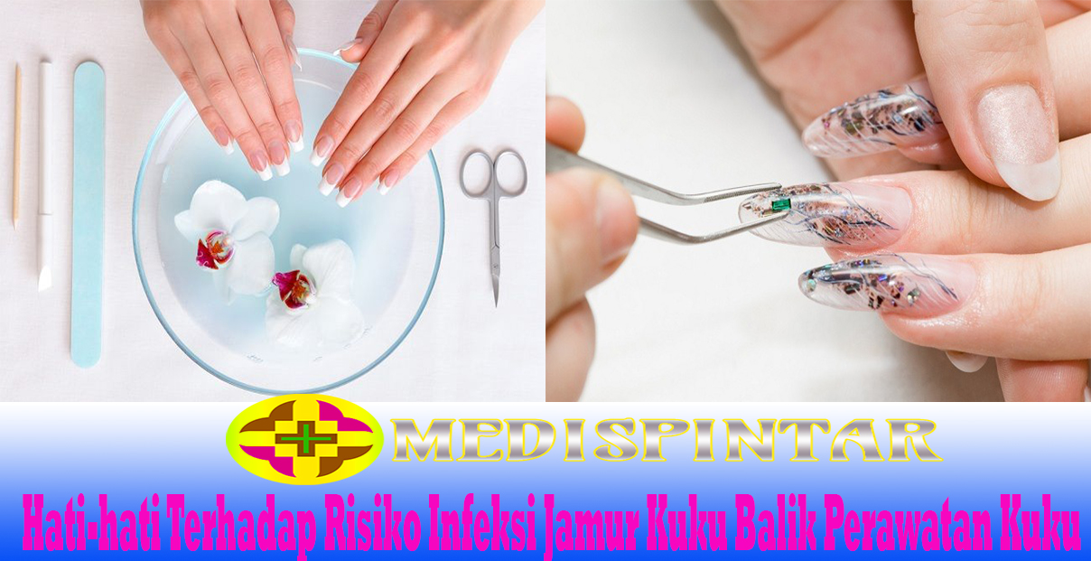 Hati-hati Terhadap Risiko Infeksi Jamur Kuku Balik Perawatan Kuku