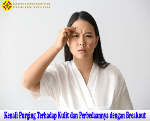 Kenali Purging Terhadap Kulit dan Perbedaannya dengan Breakout