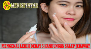 Mengenal Lebih Dekat 5 Kandungan Salep Jerawat