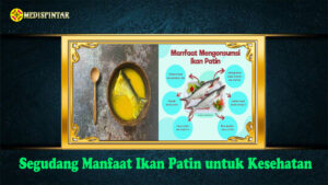 Segudang Manfaat Ikan Patin untuk Kesehatan